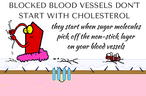 blocked blood vessels start with sugar