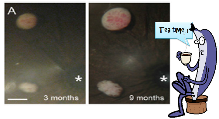 transplanted islets in anterior chamber of the eye