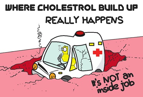 Cholesterol stuck in a blood vessel