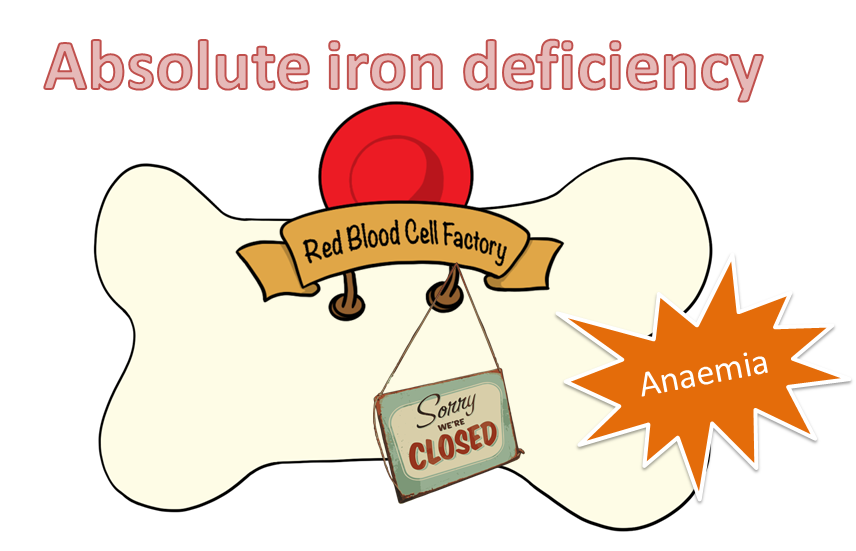 the consequences of absolute iron deficiency